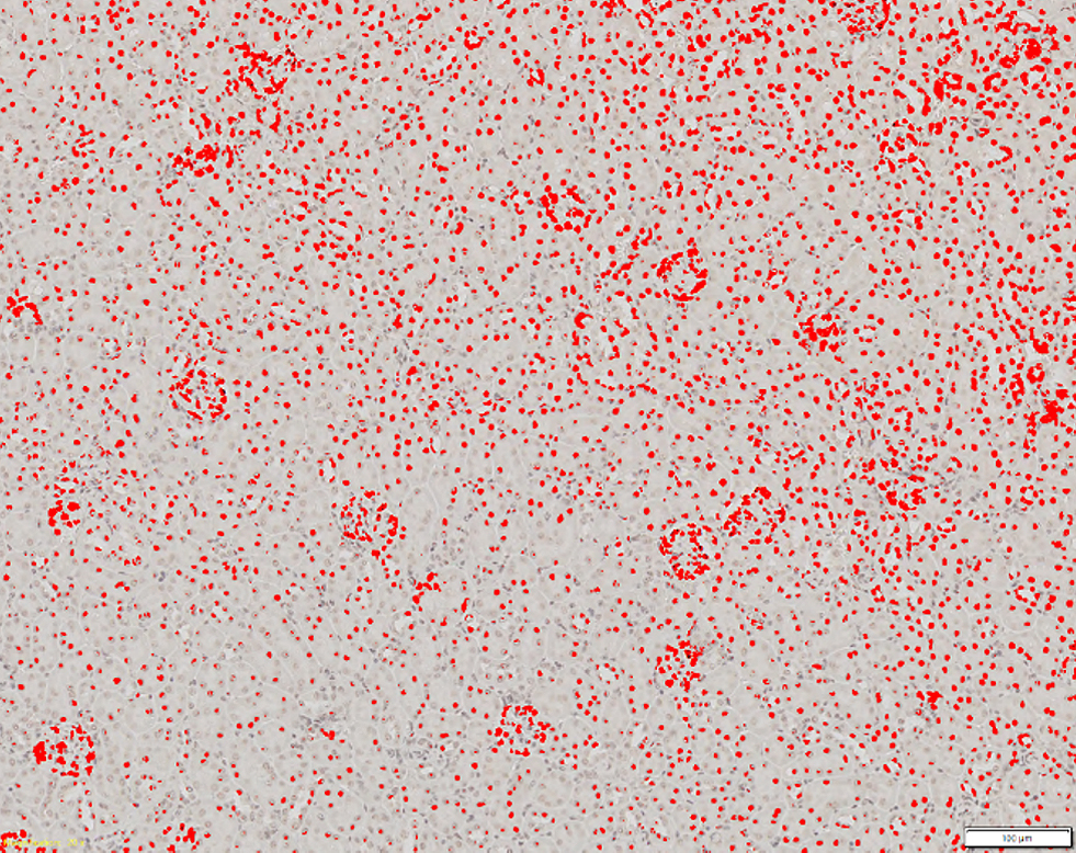 사구체 세포와 다른 세포를 구별하지 못하는 기존 임계법(빨간색) 기반 검출 결과를 보여주는 10배 확대 사진