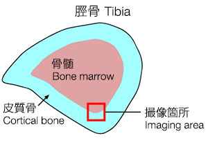 図1:脛骨の断面図