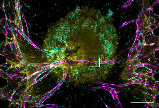 (a) 肿瘤细胞球的投影图。比例尺：200 μm，物镜：UPLSAPO10X2。