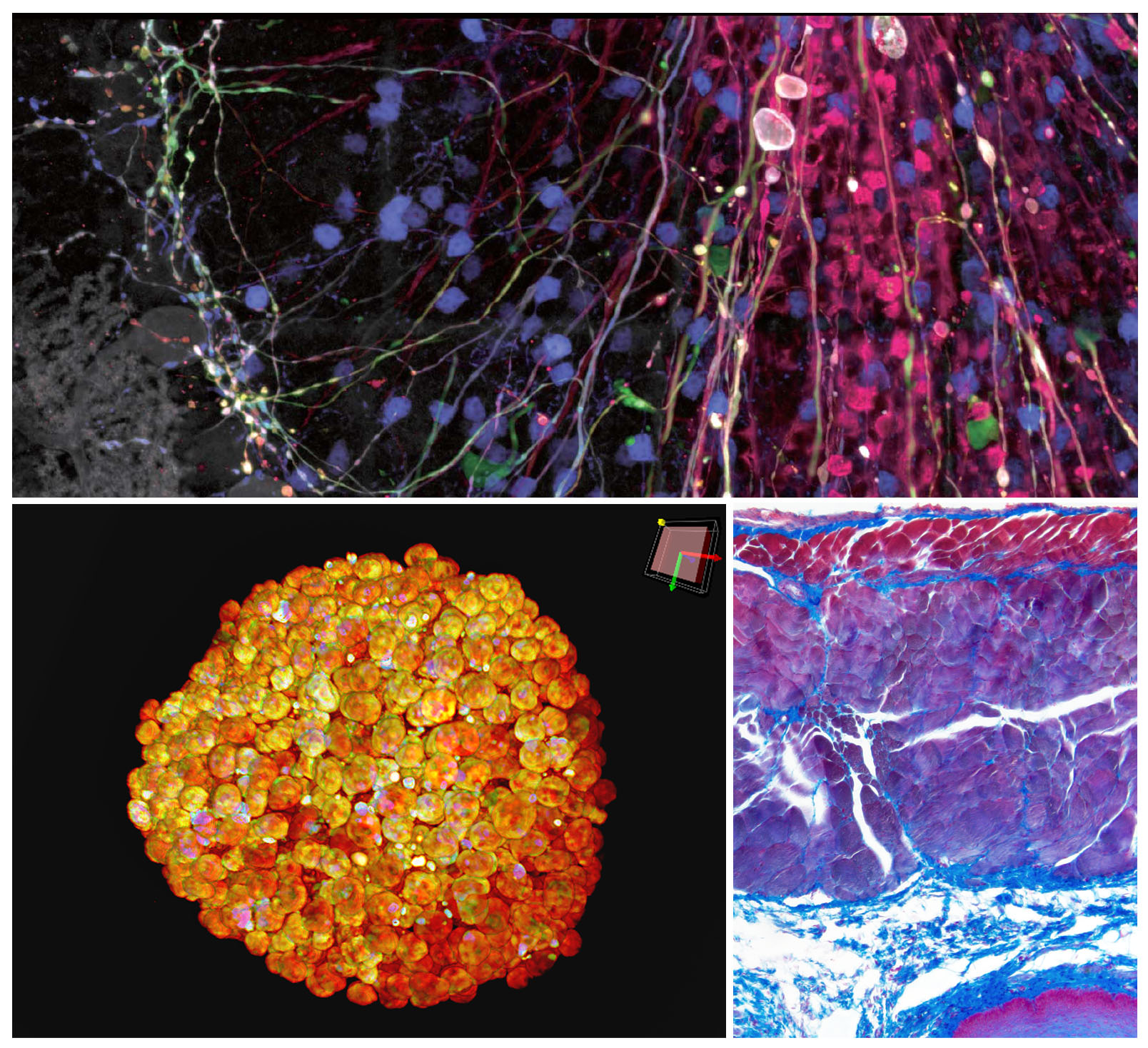 Top: Image of Brainbow AAV transfection of Purkinje cells, amplified with antibodies Purkinje cell somata, dendrites, and axons are visible, as well as some aspecific stainings of granule cells acquired by the FV3000 microscope         Bottom left: Cleared spheroid of HT-29 cells stained with DAPI (nuclear) acquired by the Olympus IXplore Spin system         Bottom right: Azan stained captured by the DP74 digital microscope camera