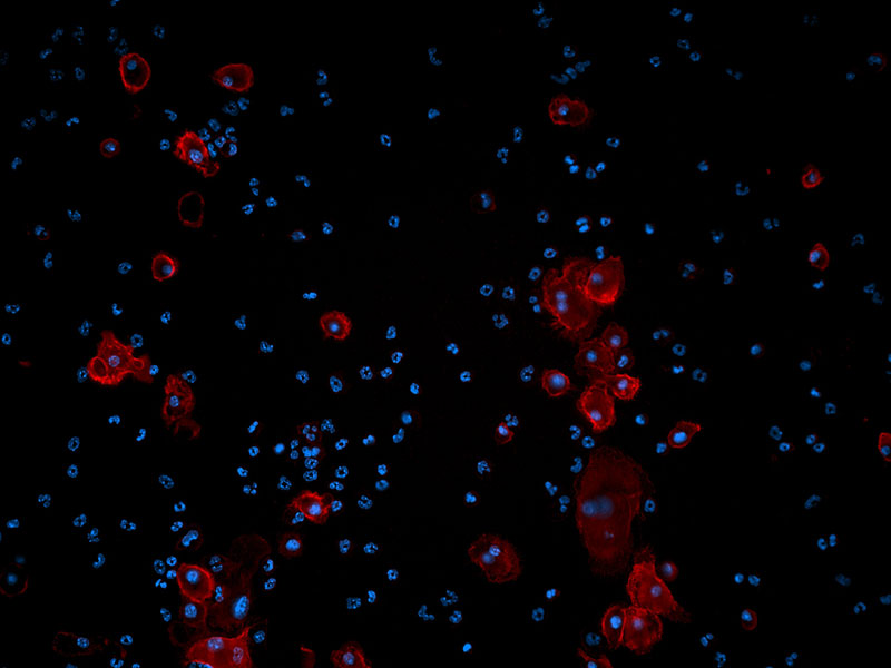 F4/80(マクロファージマーカー)を発現しているマクロファージ 青：DAPI、細胞核、 赤: Cy7、マクロファージ