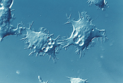 図15 微分干渉観察による培養細胞（NG108-15細胞）