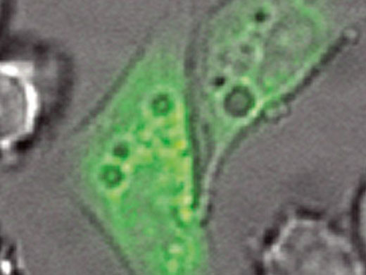 HeLa-Zellen