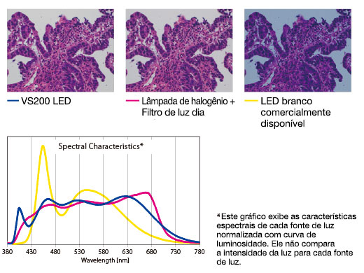 Iluminação LED brilhante otimizada para patologia e citologia