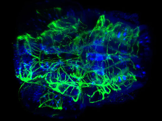 Tête transparisée d’une larve de poisson-zèbre colorée pour observer le système vasculaire et neural, grossissement 20x