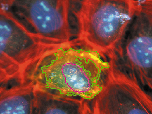 Genome-wide screen on cell arrays to identify novel genes involved in intracellular transport machinery. Image courtesy of Dr R. Peperkok, EMBL, Heidelberg, Germany