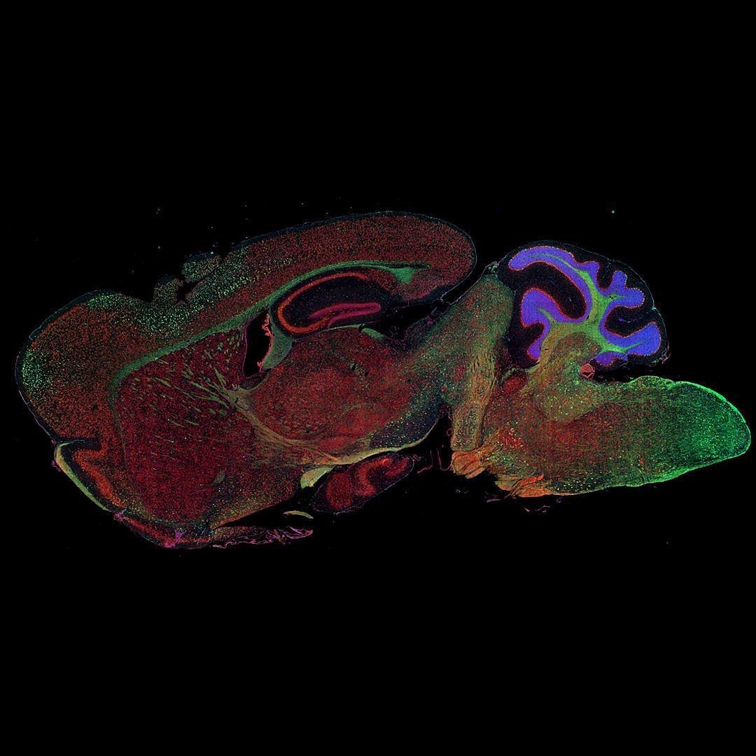 Imagen por fluorescencia del cerebro de un ratón