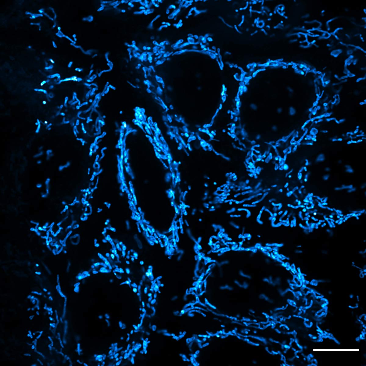 ナノマテリアルが生命科学の新たな光に； 蛍光ナノプローブが注目を 