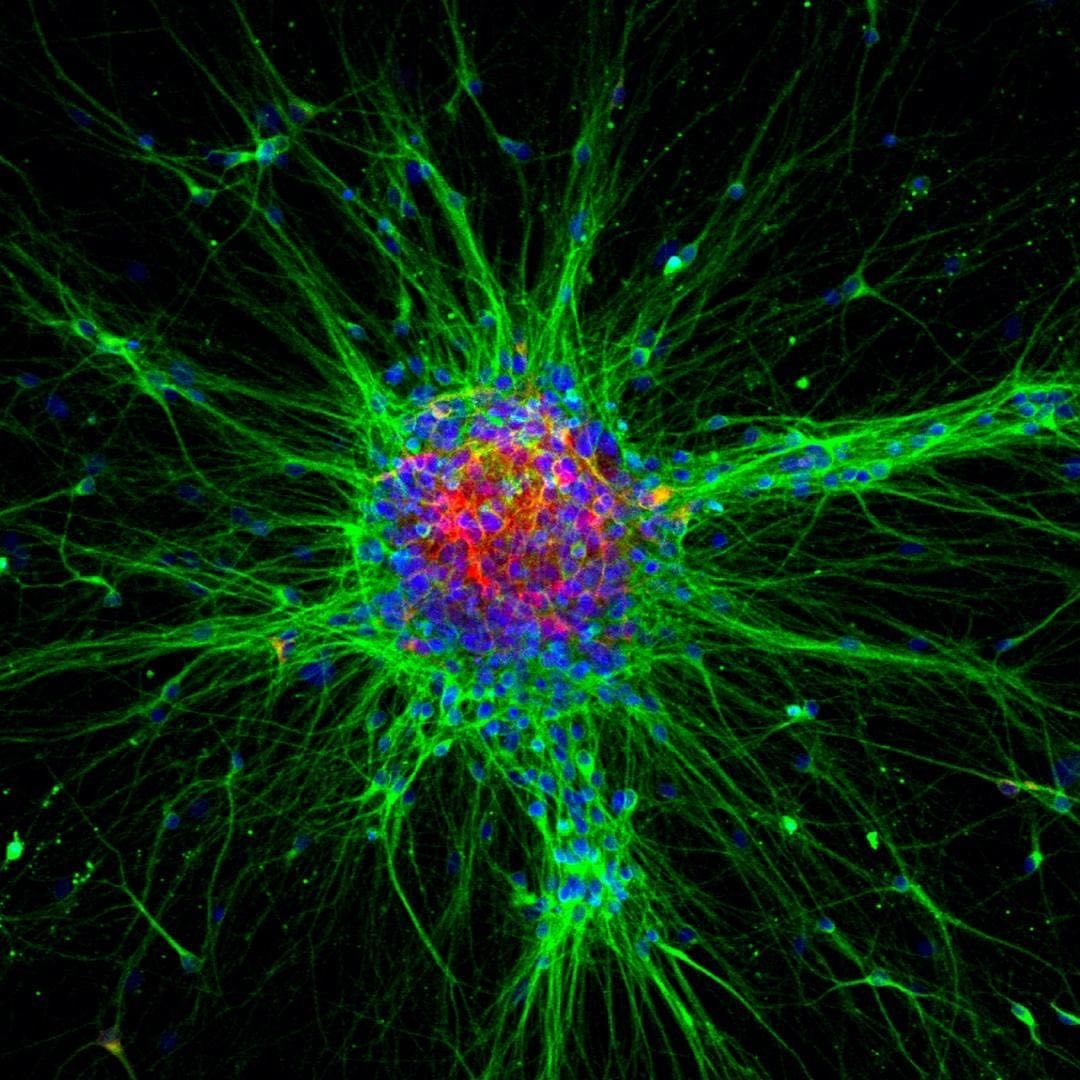 iPS 세포 뉴런