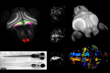 Whole-Brain Functional Calcium Imaging Using Light Sheet Microscopy
