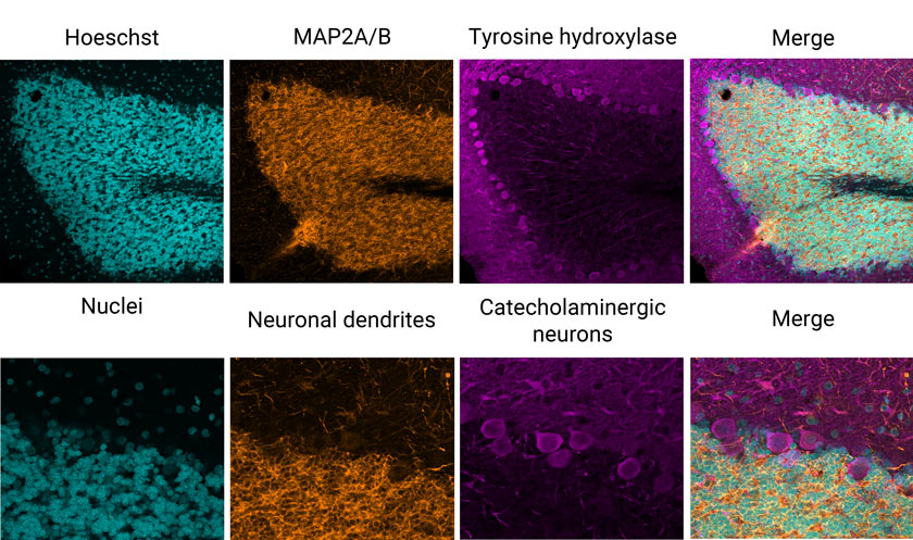 Coupe de cerveau de rat marquée par immunofluorescence tricolore