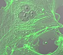 Opossum Kidney Epithelial Cells with EYFP Actin
