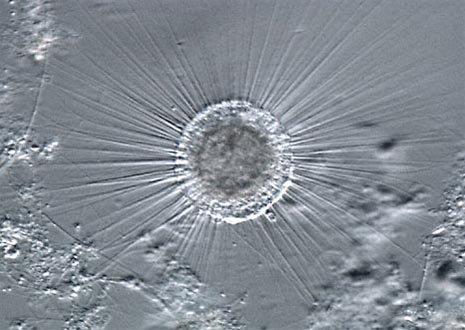 Sun Animalcules (Actinosphaerium Heliozoans)