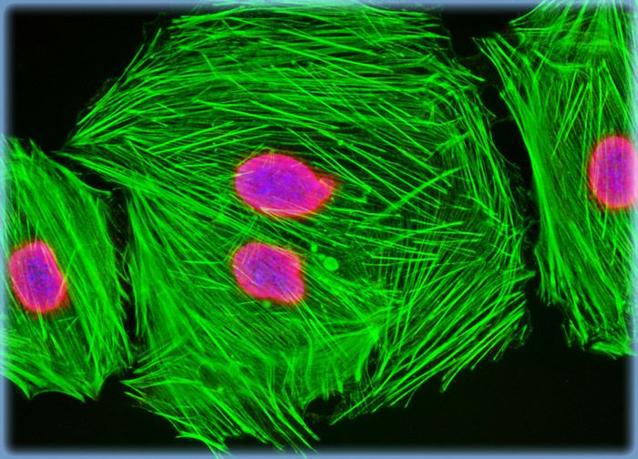 Embryonic Rat Thoracic Aorta Medial Layer Myoblast Cells (A-10 Line)
