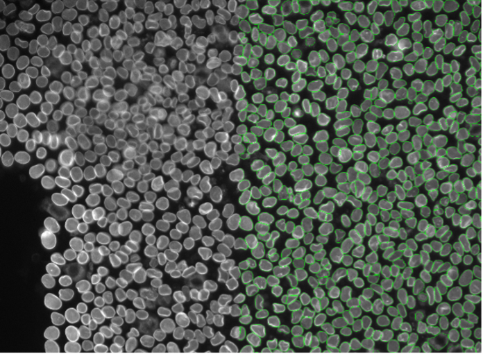 Deep learning image segmentation of plant cells