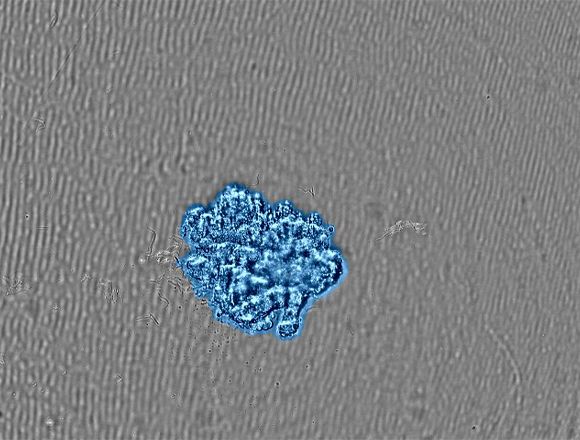 (b) Image of the spheroid grown to the target size. A confluency mask shows the detected cells in blue.
