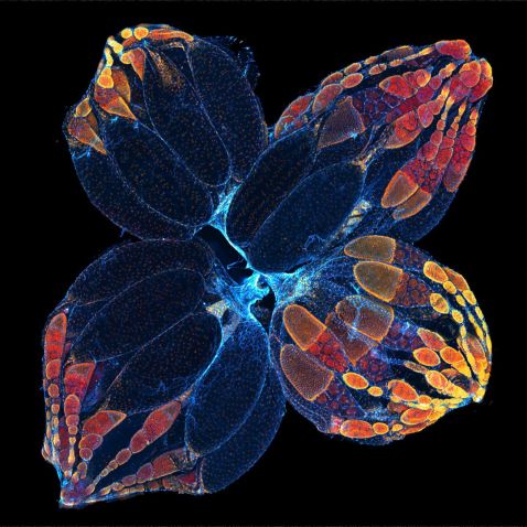 Fruit fly ovaries under a microscope