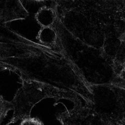 Células HeLa bajo el microscopio