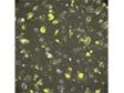 Fluoreszenz-, Phasenkontrast- und Biolumineszenz-Bildgebung lebender, auf einem Kunststoffboden inkubierter Zellen unter Verwendung eines 20X Phasenkontrastobjektivs mit hoher numerischer Apertur (NA)
