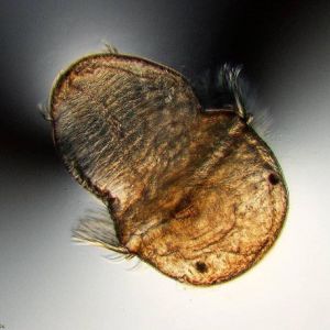 zooplankton closeup