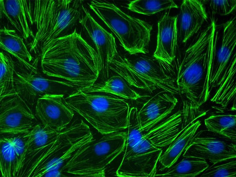 Ptk2 세포의 적용 이미지