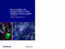 Novel Insights into the Glia Limitans of the Olfactory Nervous System（英語のみ）