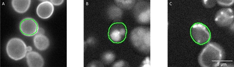 그림 3: 전달 채널(표시되지 않음)에서 분할된 개별 세포의 분할 마스크(녹색). 형광 신호는 A) 세포 주변부(웰 60, C12), B) 액포(웰 266, L2) 및 C) 미토콘드리아(웰 147, G3)에서 위치가 파악되는 단백질을 나타냅니다. 분할 마스크, 형광 채널, 웰 번호를 결합하여 scanR 소프트웨어에서 이상값 주석을 자동으로 할당했습니다.