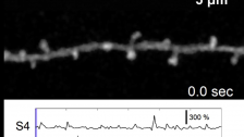 Visualization of glutamatergic synaptic inputs in vivo mouse FrA cortex using iGluSnFR.