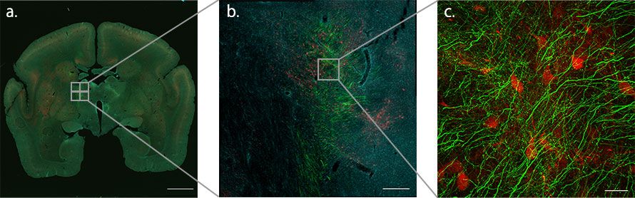 Figure 2. Using the macro-to-micro function to map where the axon fibers meet the TRN on the way to the thalamus from the PFC of the marmoset brain. Since TRN neurons are composed of PV-positive inhibitory neurons, they can be identified by the PV antibodies (red). Green indicates axon terminals from the cerebral cortex and cyan indicates nuclei.