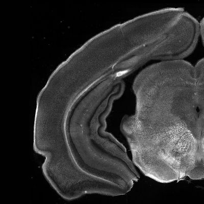 マウス脳の冠状断面の全体像
