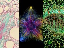 Stars of the Show—Our Most Popular Microscope Images for July 2023
