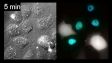 IX83: 刺激によるERK活性化の細胞間伝搬の機構をFRETイメージング