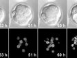 Quatro dicas para obter imagens mais longas de células vivas com menos tempo em laboratório