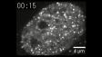 IX83: マウス胚由来細胞の核内に存在するポリコム複合体のフォトブリーチング