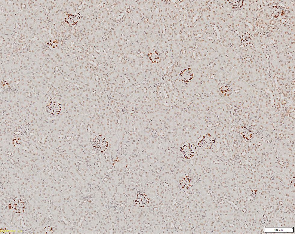 grossissement x20 d’une coupe de tissu rénal avec glomérules marqués apparaissant en marron foncé
