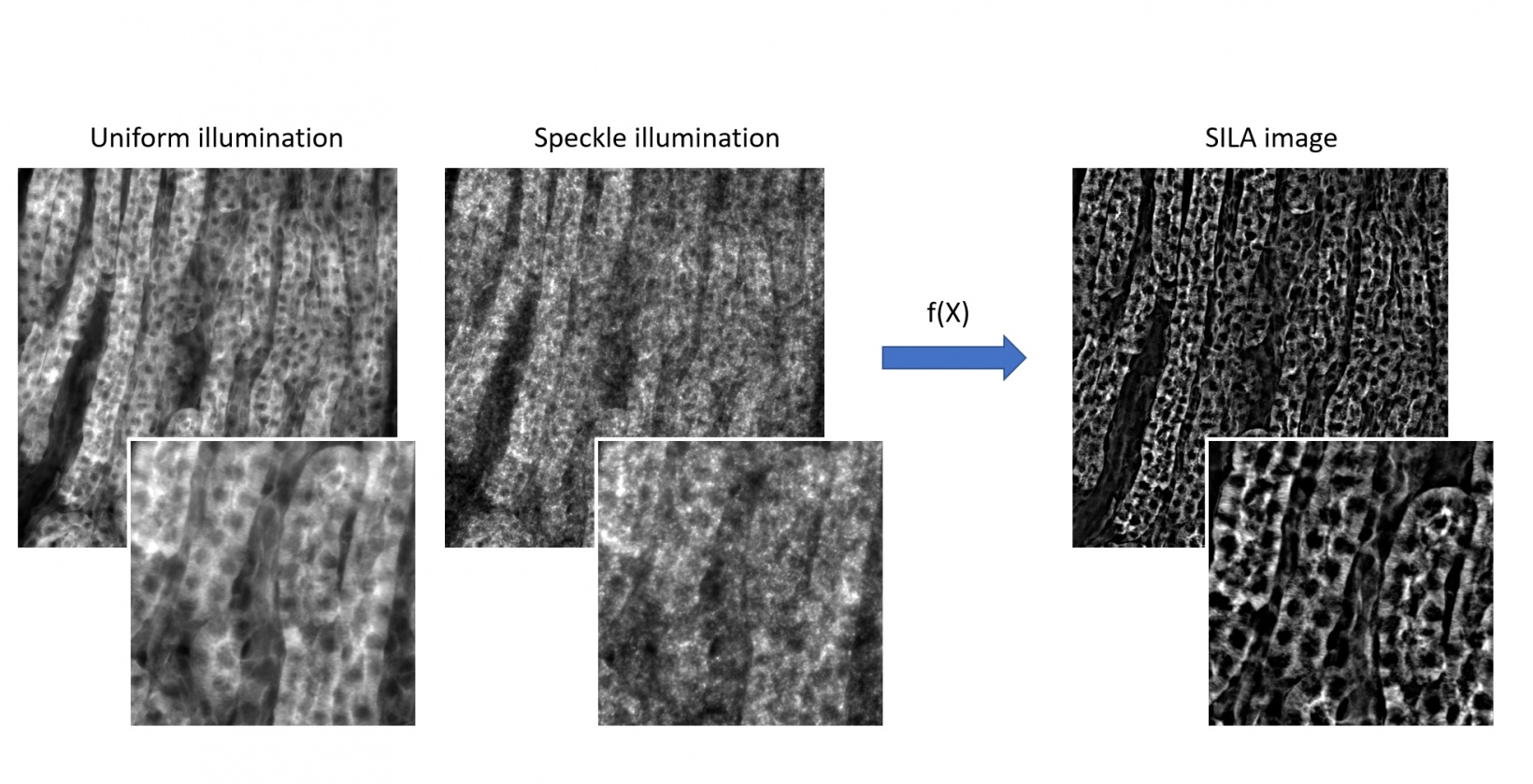 Processamento rápido com a capacidade de visualização em tempo real de imagens seccionadas opticamente