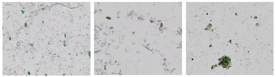 Images d’échantillons de matières fécales montrant des œufs de parasites prises au microscope 