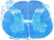 Detrás de la lente: Imágenes de neurociencia dignas de portada procesadas por la Dra. Stephanie Shiers