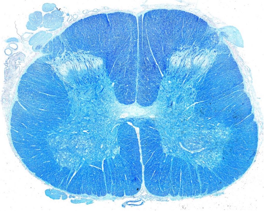 染色したヒト脊髄のホールスライド画像